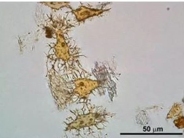 据称8000万年前的鸭嘴龙骨质细胞显微镜图片