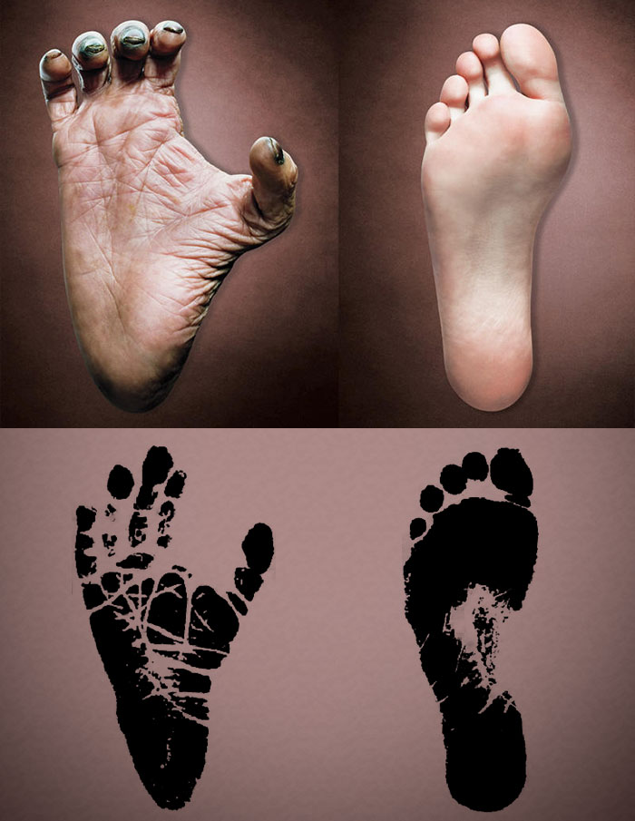 人类的脚与猿类的脚的区别